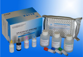 弓形虫抗体(IgG)检测试剂盒（酶联免疫法）